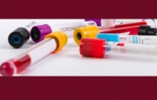 Korona’dan sonra  Kawasaki tehdidi