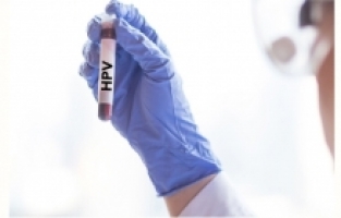 "Siğiller kanser yapabilir”